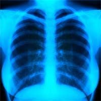1520527_lungs2