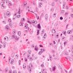 Epithelioid cells