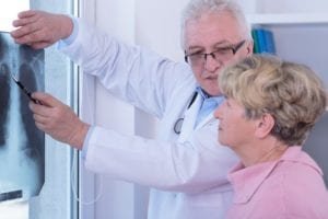 Certain factors lead to longer mesothelioma survival