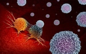 mesothelioma immunotherapy response