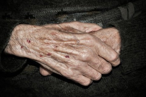 elderly mesothelioma patients