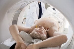 low-dose ct screening for mesothelioma