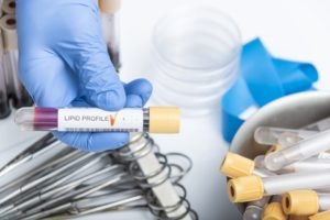 mesothelioma diagnostic process