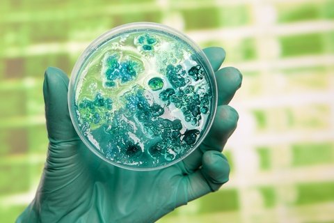 Diagnosing Mesothelioma with DNA in Cancerous Cells